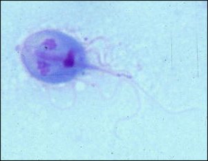 Giardia